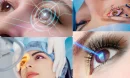 Lazer Göz Tedavisi Nedir ve Nasıl Çalışır?