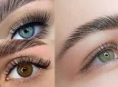 Kaş Laminasyonu Nedir?