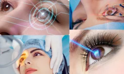 What is Laser Eye Surgery and How Does It Work?