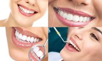 Türkiye'de Diş Kliniği - كلينك اسنان في تركيا Ücretleri Nasıl Değişir?