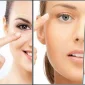 Kepçe Kulak Estetiği Otoplasti Risk Taşıyor Mu?