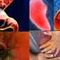Gastric Sleeve Surgery